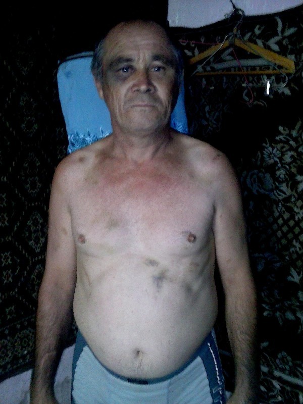 На снимке, сделанном сыном пострадавшего, видно, что у Александра Альбрандта не осталось места, к которому не приложились бы тяжелые кулаки и ноги полицейских. На снимке, сделанном сыном пострадавшего, видно, что у Александра Альбрандта не осталось места, к которому не приложились бы тяжелые кулаки и ноги полицейских.